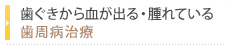 歯ぐきから血が出る・腫れている歯周病治療